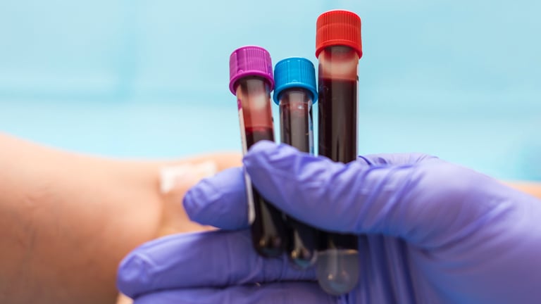 Blood test vials held by nurse for blood analysis