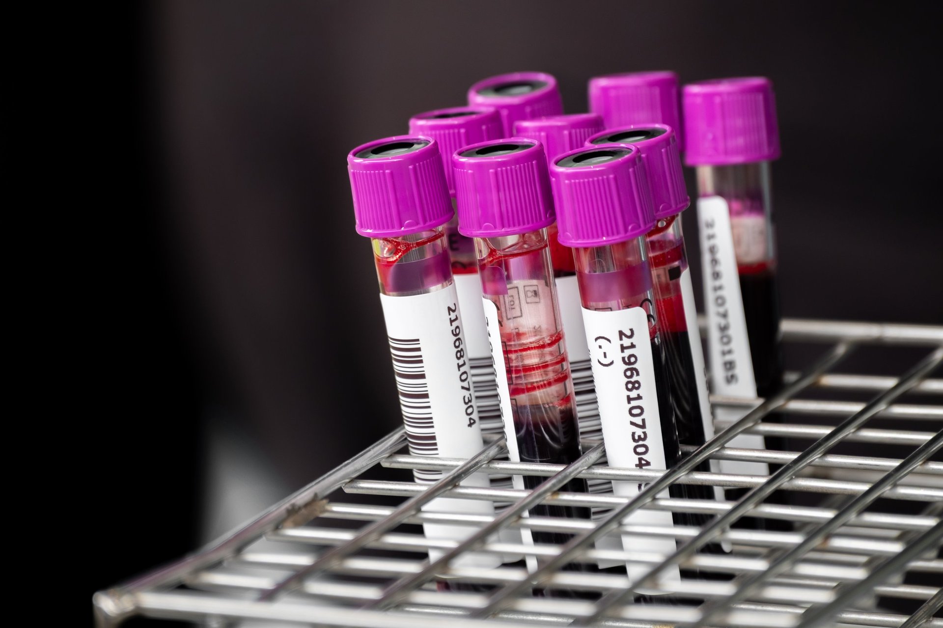 Close up of blood samples in test tubes with purple caps arranged in a metal rack at a laboratory